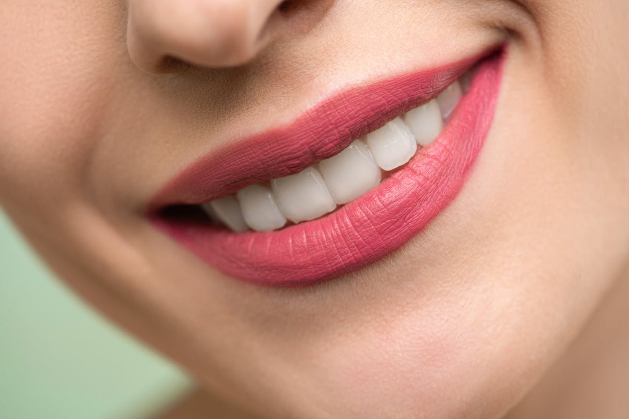 Impianti dentali